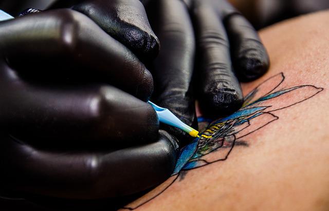 Como funciona o processo de remocao-da tatuagem